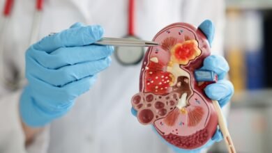 Cálculo renal causas sintomas danielhampl.com.br