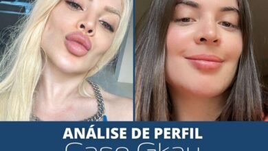 A Influenciadora Gkay remove o preenchimento labial exagerado