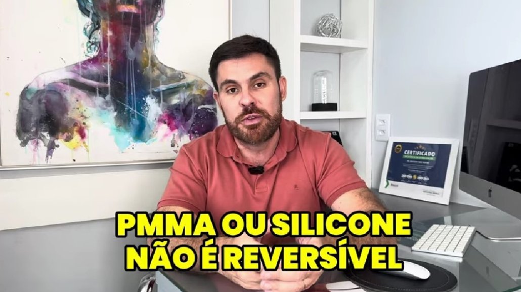 Excesso de preenchimento com ácido hialurônico
