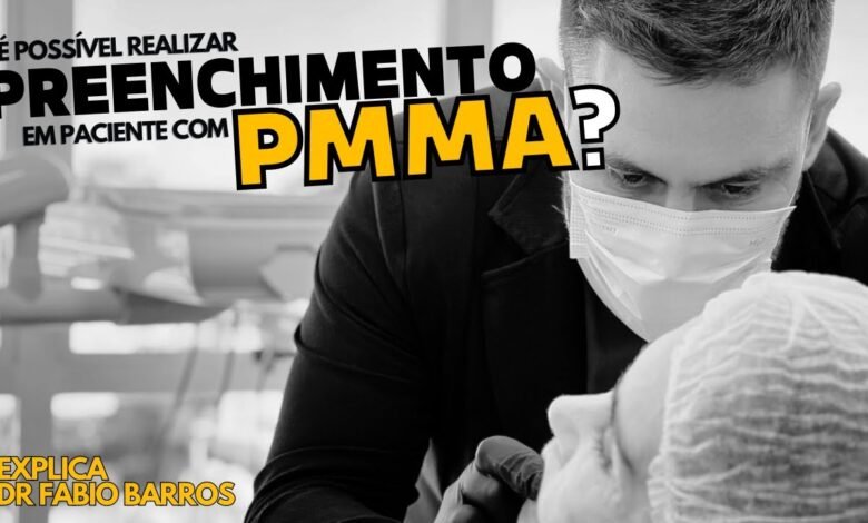 É possível realizar o preenchimento com ácido hialurônico em pacientes com PMMA