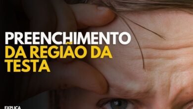 Preenchimento da testa: quando é indicado?